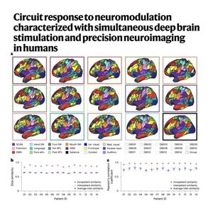 951-Precision Neuroimaging of Human Circuit Responses
