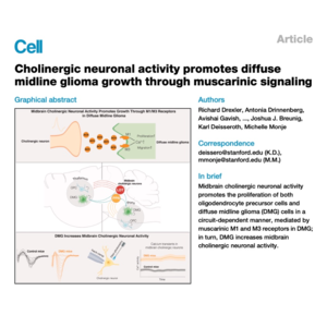 081-Cholinergic neuronal promotes diffuse midline glioma