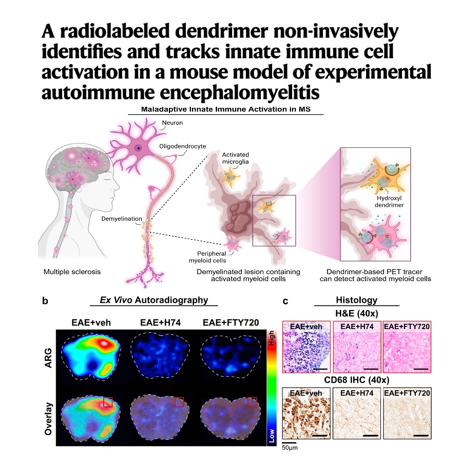 621-Tracking Innate Immune Activation in Multiple Sclerosis episode artwork