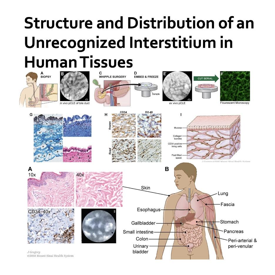 1040-The Structure and Distribution of Human Interstitium episode artwork