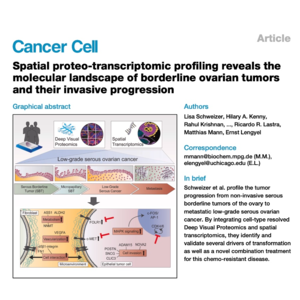 085-Spatial landscape of borderline ovarian tumors