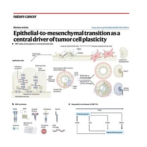 1378-Epithelial-to-Mesenchymal: Engine of Tumor Plasticity