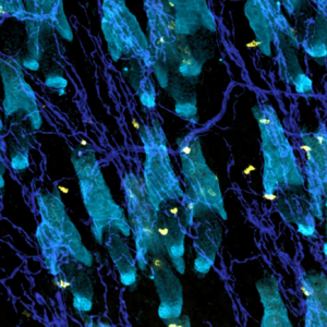 E026 皮囊、拓扑、叛乱｜精神压力如何松懈免疫监视
