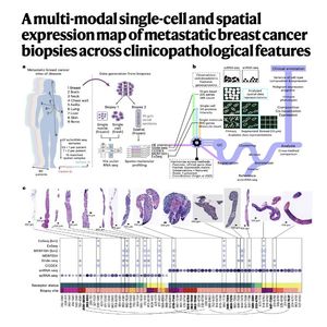 896-Spatial Map of Metastatic Breast Cancer Biopsies