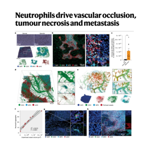 065-Neutrophils drive tumour necrosis and metastasis