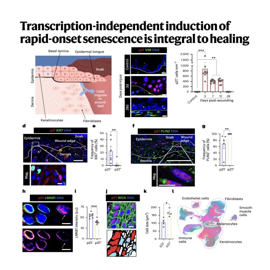 1289-Transcription Senescence Promotes Rapid Tissue Healing episode artwork