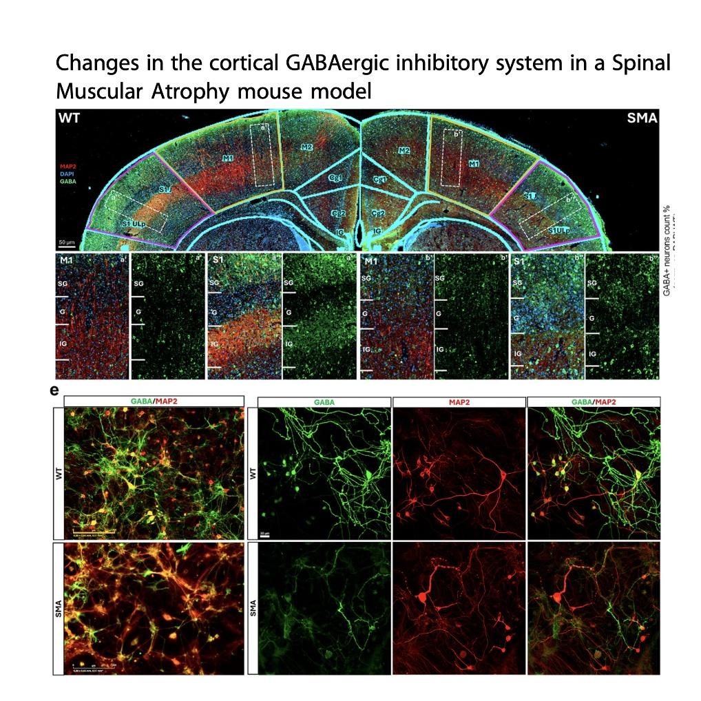 1435-GABAergic Inhibitory Dysfunction in Spinal Muscular episode artwork