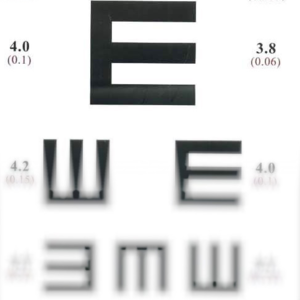 VOL.37眼科|你近视吗?眼睛保健操到底有用吗?|为何我国闭角型青光眼发病概率大?