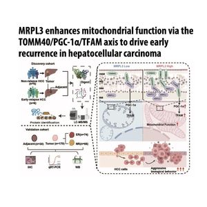 1457-MRPL3 Driven Early Hepatocellular Carcinoma Recurrence