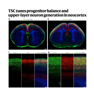 335-TSC tunes Cortical Progenitor Balance and Neurogenesis