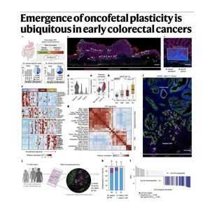 901-Oncofetal Plasticity in Early Colorectal Cancer