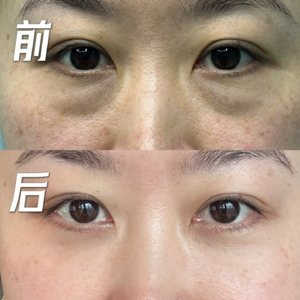 02.八千的眼袋卖十万?医生自己做什么项目?医美水深,大胆开麦！