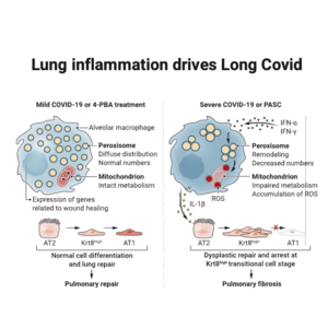 019-Lung inflammation drives Long Covid
