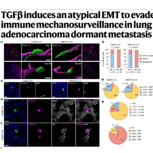 686-TGFβ-Induced Atypical EMT and Immune Mechanosurveillance