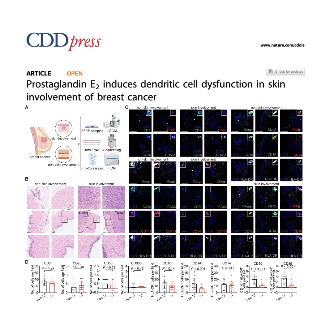 1438-PGE2-Driven Dendritic Cell Dysfunction in Breast Cancer episode artwork