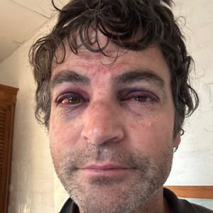 vol.3 风暴中飞行员被卷至海拔 7300 米处并幸存