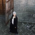 斗鸡眼的小兔仔