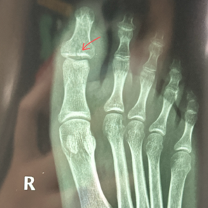 再次提醒自己：很多事做起来没有想象的那么难 📅 Aug.26